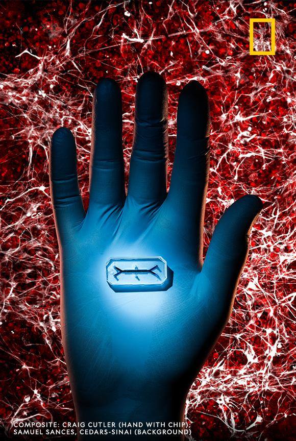 In a new era of healthcare, our health will be monitored continuously, and treatments will be based on an individual's unique biochemical makeup. Learn more about the highly individualized treatments teetering at the edge of the medical frontier, and join us for a Q&A with writer Fran Smith TODAY at 2pm E.T. Ask questions in the comments below! https://on.natgeo.com/2RSEMnv